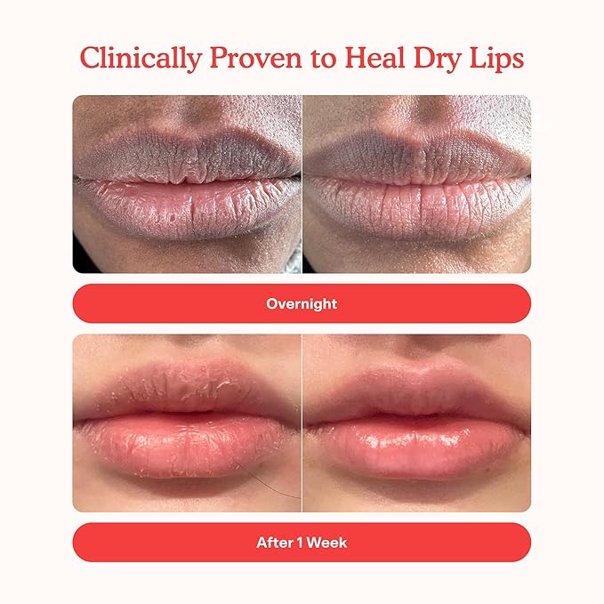 Tower 28 LipSoftie Tinted Lip Balm Treatment - Hydrating Glossy Balm + Overnight Lip Mask with Jojoba Oil + Shea Butter - Sweet, Cushiony Formula for Smooth, Soft Lips - Dulce De Leche (0.38 oz)