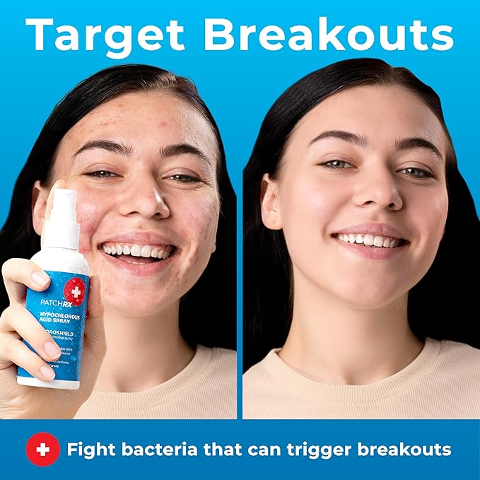 PatchRx Hypochlorous Acid Spray (8oz, 2 packs), HOCL Facial Cleanser Acne Spray for Face, Body, Eczema, Pimples, Breakouts & Overall Skin Recovery (Reduces Redness)