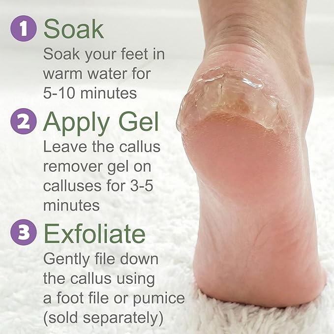 Dr. Entre's Callus Remover Gel: Extra Strength Callus Remover for Feet, Foot Callus Remover, Foot Care, Pedicure Tools Supplies, Dead Skin Remover, 4 oz