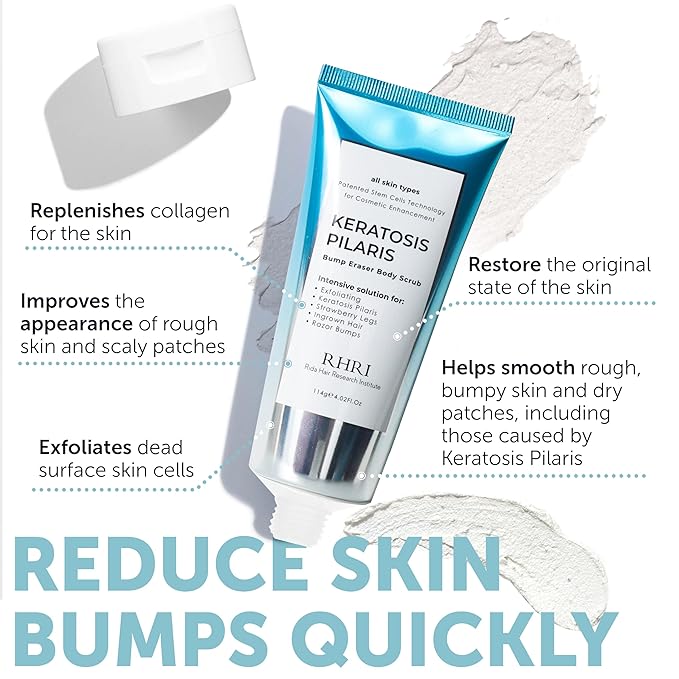 KP Bump Eraser Body Scrub with 10% AHA | Keratosis Pilaris Treatment | Bump Eraser Body Scrub | Ingrown Hair Treatment | Clears Strawberry Legs | Soothes Redness, Dryness & Flaky Skin