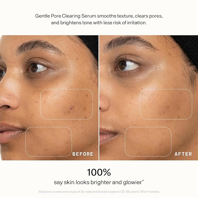 VERSED Skin Refine Gentle Pore Clearing Serum | Exfoliating Facial Serum with Salicylic Acid and Mandelic Acid for Clear Skin | Safe for Sensitive Skin, Vegan, 30 ml / 1 fl oz