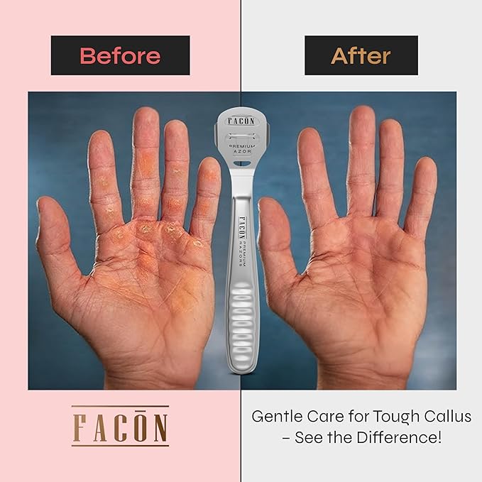 Facón Professional Callus Shaver Remover with 50 Blades, Pedicure Razor for Feet & Hands, Foot Razor for Callus Removal, Callus Blade Remover, Corn Shaver, Surgical Grade Premium Stainless Steel Tool