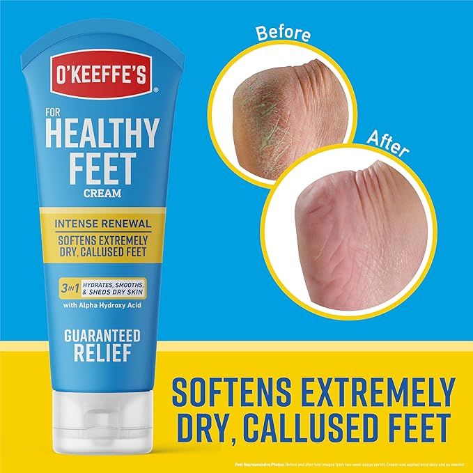 O'Keeffe's for Healthy Feet Intense Renewal Cream with Urea & Alpha Hydroxy Acid - 3 oz Tube - Chemically Exfoliates and Softens Extremely Callused, Dry Feet (Pack of 2)