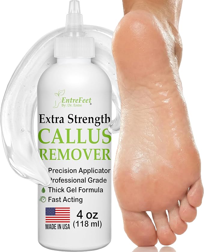 Dr. Entre's Callus Remover Gel: Extra Strength Callus Remover for Feet, Foot Callus Remover, Foot Care, Pedicure Tools Supplies, Dead Skin Remover, 4 oz