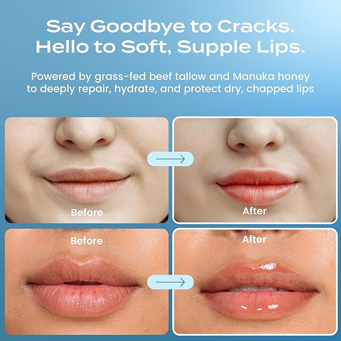 Body Restore Collagen Lip Mask – Mothers Day Gifts for Mom, Hydrating Lip Treatment, Birthday Gifts for Women, Self Care Spa Gifts – Peppermint