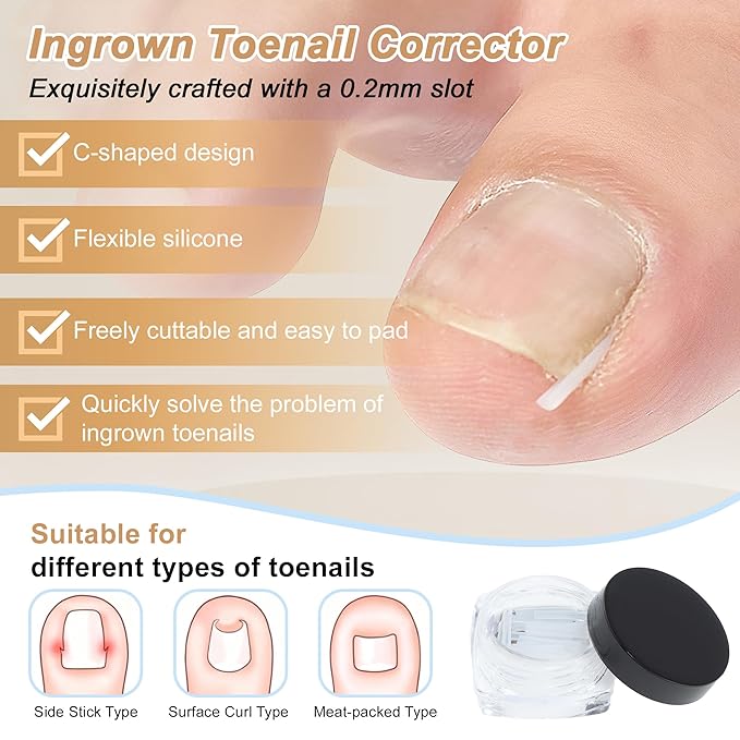 VOCOSTE Ingrown Toenail Correction Kit, Toe Nail Corrector Tools with Leather Case for Easy Storage & Travel, for Curved & Ingrown Nails with Nail Files Clipper Lifter