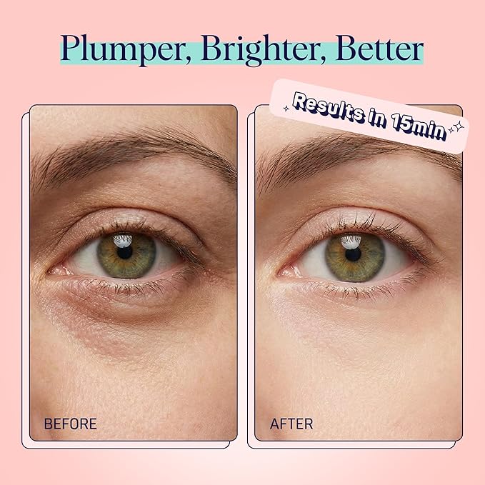 SpaLife Watermelon Cooling Eye Pads, Mothers Day Gifts, 48 Hydrating Under Eye Patches for Puffiness, Dark Circles, and Tired Eyes, Infused with Hyaluronic Acid, Glycerin, and Vitamin C, Fruity Scent