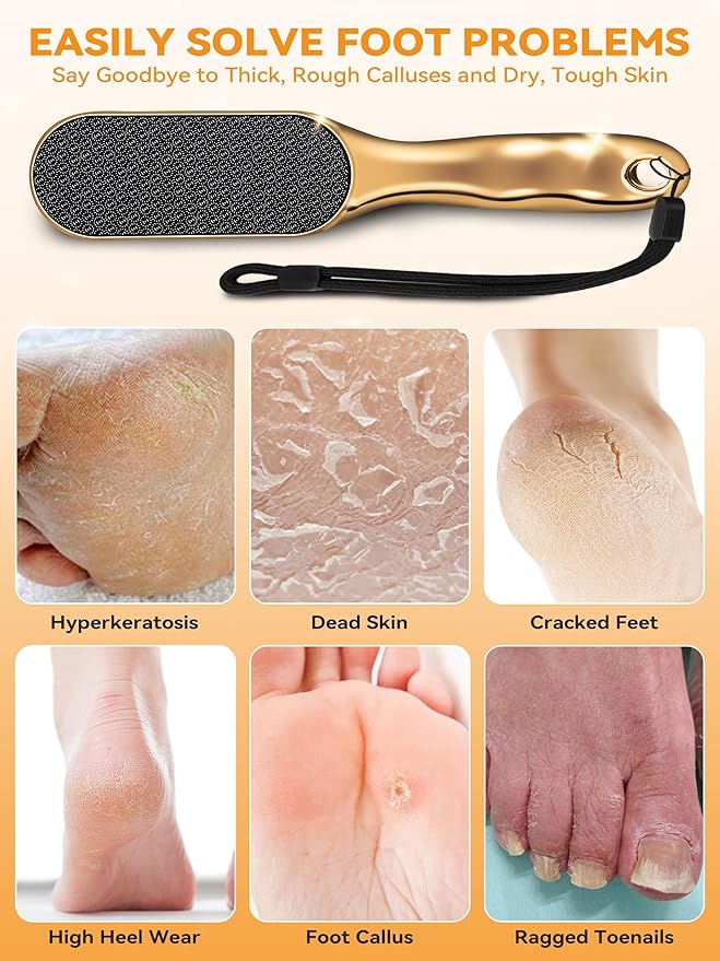 Beyond The Cream Veins Grain Foot File, Nano Glass Foot File, Hard Skin Callus Remover, Professional Pedicure Tool, Anti-Slip Handle Rope & Storage Bag, Ideal Gift for Beauty & Fitness Lovers, 2-Pack
