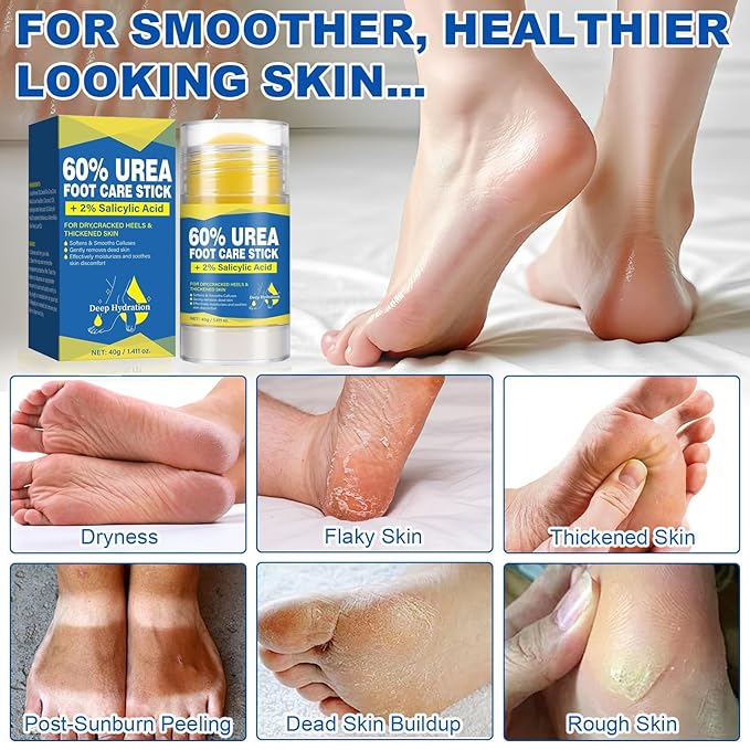 60% Urea Stick with 2% Salicylic Acid, Moisturizer for Dry Cracked Feet, Knees, Elbows & Hands, Exfoliating Softener, Cracked Feet and Callus Removal - 1.41 Oz (2pcs)