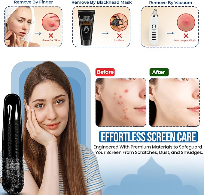 EFAH Care 2Pcs Stainless Steel Pimple Extractor Acne Treatment Tool Surgical Blemish Grade Blackhead Remover Perfect for face and Nose Easy to Clean (Black)