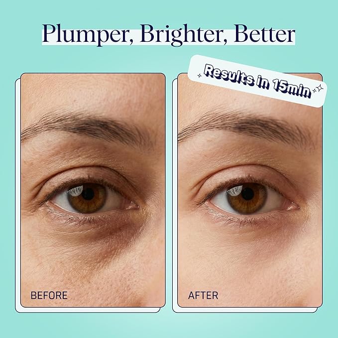 SpaLife Cooling Cucumber Eye Pads | Mothers Day Gifts & Korean Dark Circles & Puffy Eyes Treatment | Nourishing Cucumber Eye Pads | Eye Mask for Puffy Eyes Daily Depuffing Eye Patches | 4 Packs of 12