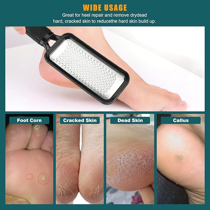 Foot Files Callus Remover 2 Pcs Stainless Steel Professional Pedicure Foot Rasp and Dual Sided Scrubber Foot Care Tools to Removes Hard Skin Corns for Dry and Wet Fee