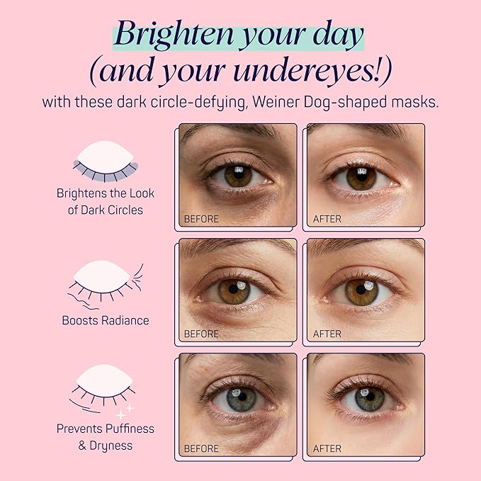 SpaLife So Fetch Hydrogel Under Eye Patches for Dark Circles | Mothers Day Gifts | Dachshund Under Eye Patches for Puffy Eyes | Weiner Dog Undereye Bags | Pack of 8 Pairs (8 Undereye Treatments)
