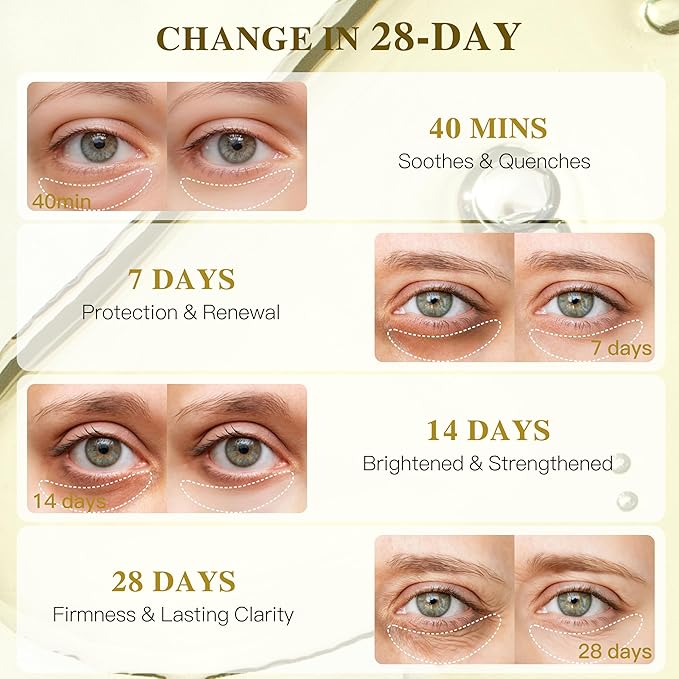 Turmeric Vitamin C Under Eye Patches, Eye Mask for Puffy Eyes and Dark Circles, Deep Hydrating Under Eye Mask Patches for Eye Bags Treatment, Under-eye Skincare for Soothing (12 pairs)