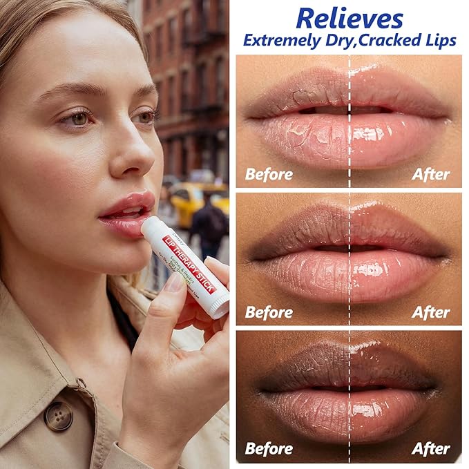 Dmsky Lip Therapy Lip Balm Stick,10 Natural Berry Flavor Healing Hydrating Chapstick Bulk for Chapped Lips Severe,Dry Lips,0.15 OZ,Pack of 20
