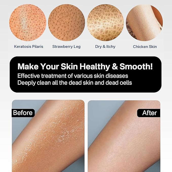 Yiclick Heavy Exfoliating Gloves, Exfoliating Body Scrubber for Bath Shower Exfoliation, Body Scrub Exfoliator for Dead Skin Remover, Exfoliate Sponge Loofah Washcloth Mitt Men Women