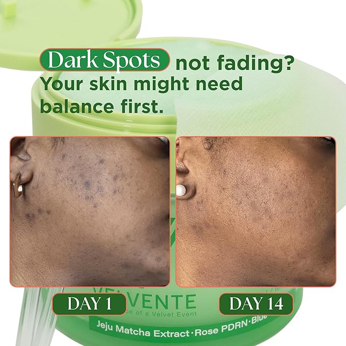 Matcha Toner Pads (100 Pads) with Rose PDRN, Peptides & Hyaluronic Acid | Korean Facial Pads for Dark Spot, Acne Prone & Uneven Skin Tone, Soothing Radiant Skin, Makeup Prep Daily Skincare