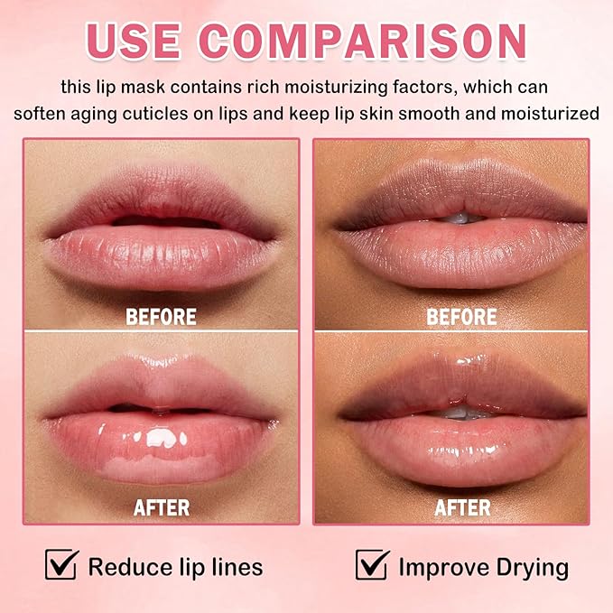 Honey Pot Lip Balm Set,4PCS Strawberry Watermelon Coconut Honey Lip Balm,Moisturizing and Repair Bee Lip balm honey Pot,Prevention Dry and Crack Lip Sleeping Mask
