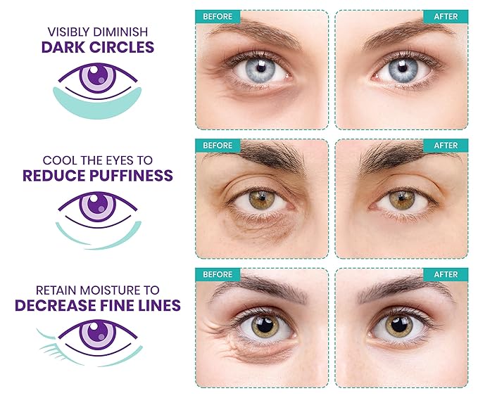 Stylia Under Eye Patches for Puffy Eyes and Dark Circles (30 Pairs) - Marine Collagen Under Eye Mask with Retinol, Vitamin C, Hyaluronic Acid, Pearl Extract - Eye Masks for Dark Circles and Puffiness