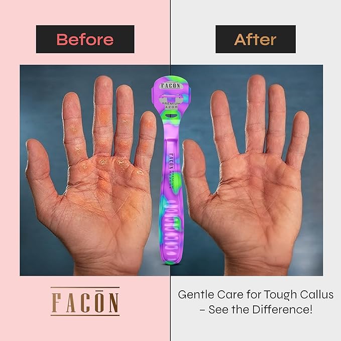 Facón Professional Callus Shaver Remover with 50 Blades, Pedicure Razor for Feet & Hands, Foot Razor for Callus Removal, Callus Blade Remover, Corn Shaver, Surgical Grade Premium Stainless Steel Tool