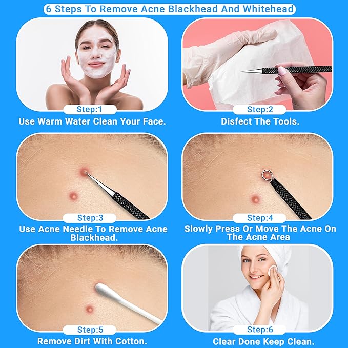 EFAH Care 2Pcs Stainless Steel Pimple Extractor Acne Treatment Tool Surgical Blemish Grade Blackhead Remover Perfect for face and Nose Easy to Clean (Black)
