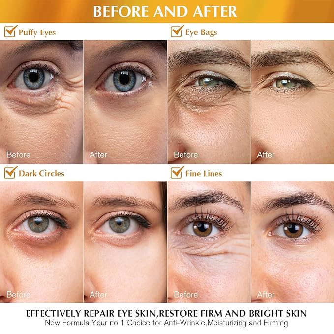 Enaskin Naturals Under Eye Patches Dark Circles Under Eye Masks for Puffiness - 24K Gold Eye Gel Pads Retinol Collagen Hyaluronic Acid Moisturizing & Reducing Wrinkles (24K Gold)