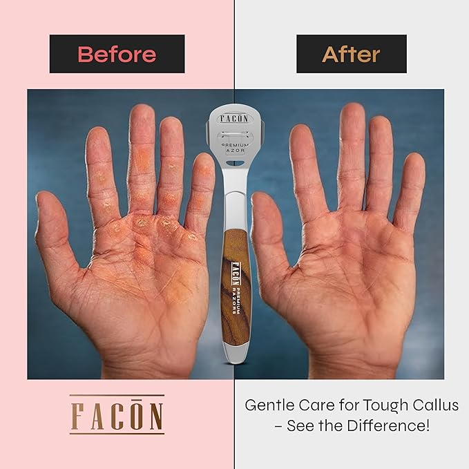 Facón Professional Callus Shaver Remover with 50 Blades, Pedicure Razor for Feet & Hands, Foot Razor for Callus Removal, Callus Blade Remover, Corn Shaver, Surgical Grade Premium Stainless Steel Tool
