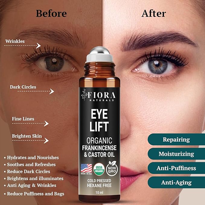 Organic Castor Oil and Frankincense Roll On – 100% Pure Hexane Free Eye Oil for Under Eye, Reduces Wrinkles, Dark Circles & Puffiness, Frankincense Essential Oil for Face Roller by Fiora Naturals