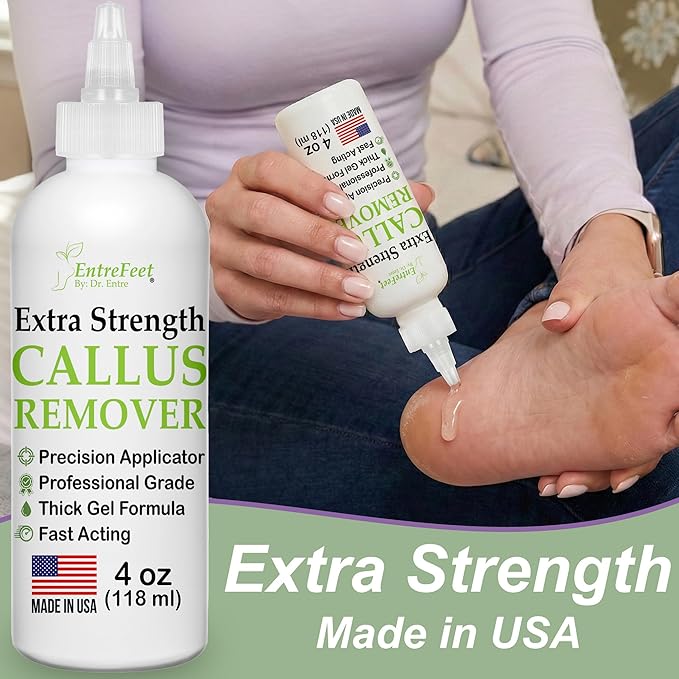Dr. Entre's Callus Remover Gel: Extra Strength Callus Remover for Feet, Foot Callus Remover, Foot Care, Pedicure Tools Supplies, Dead Skin Remover, 4 oz