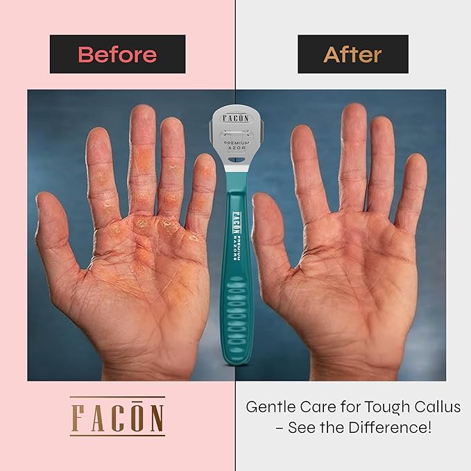 Facón Professional Callus Shaver Remover with 50 Blades, Pedicure Razor for Feet & Hands, Foot Razor for Callus Removal, Callus Blade Remover, Corn Shaver, Surgical Grade Premium Stainless Steel Tool