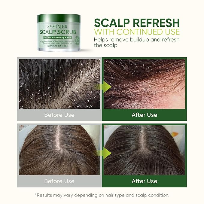 Svvimer Scalp Care Essentials – Scalp Scrub and Scalp Massager Brush Options (Scalp Scrub)