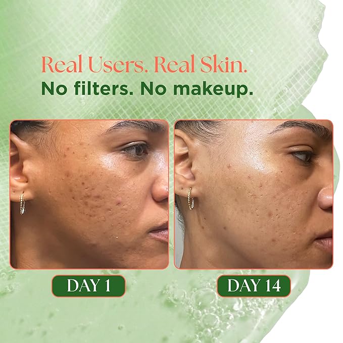 Matcha Toner Pads (100 Pads) with Rose PDRN, Peptides & Hyaluronic Acid | Korean Facial Pads for Dark Spot, Acne Prone & Uneven Skin Tone, Soothing Radiant Skin, Makeup Prep Daily Skincare