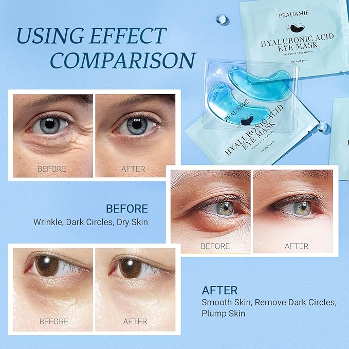 PEAUAMIE Under Eye Patchs Hyaluronic Acid Eye Mask for Dark Circles and Puffiness Wrinkle Eye Bags 30 Pairs