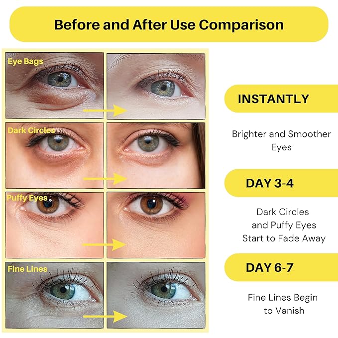 Collagen Under Eye Patches - Anti-Aging, Dark Circle & Puffy Eye Treatment - Hydrates and Firms Skin - 30 Pairs