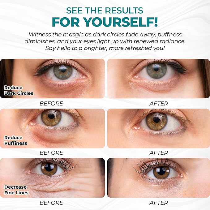 Eye Patches for Reducing Puffy Eyes and Dark Circles (60 patches), Wrinkles (Anti - Wrinkle) | Eye mask patches for Skincare with Retinol, Collagen, Hyaluronic Acid, Green Tea | Anti Wrinkle Patches