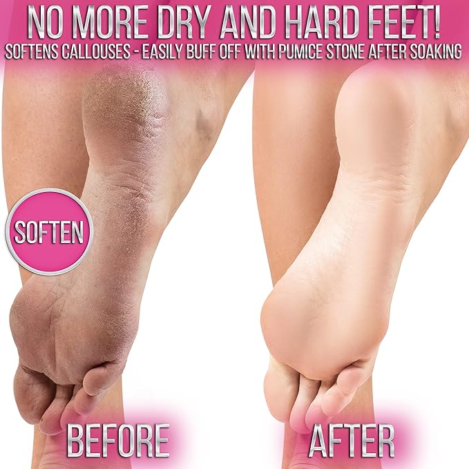 Crafts And The City SOO Jelly Pedicure Packs - Pedicure Foot Soak For Feet - Moisturizing Jelly Spa Pedi Soak - Foot Spa Bath Soak For Soaking - Pedicure Foot Gel To Relax Sore Feet (Damascus Rose)