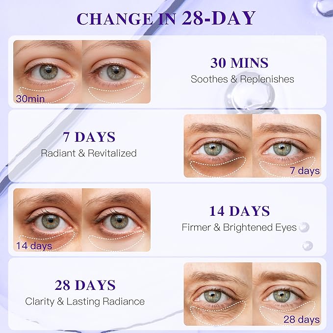 Grape Seed Collagen Under Eye Patches, Eye Mask for Puffy Eyes and Dark Circles, Deep Hydrating Under Eye Mask Patches for Eye Bags Treatment, Under-eye Skincare Boost Radiance (24 pairs)