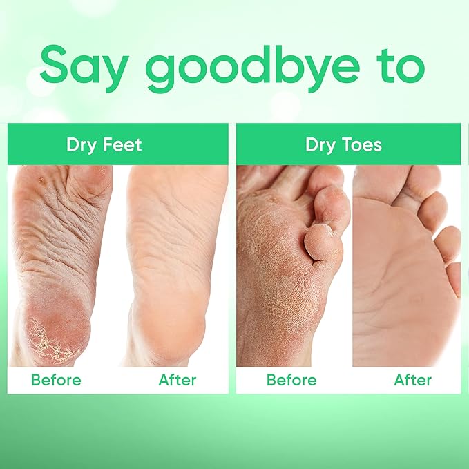 Foot Peel Mask - Foot Mask for Baby Soft Skin - Remove Dead Skin, Dry, Cracked Feet & Callus, Foot Spa, Made with Aloe Vera Extract for Women and Men (2 Pairs) | Peppermint
