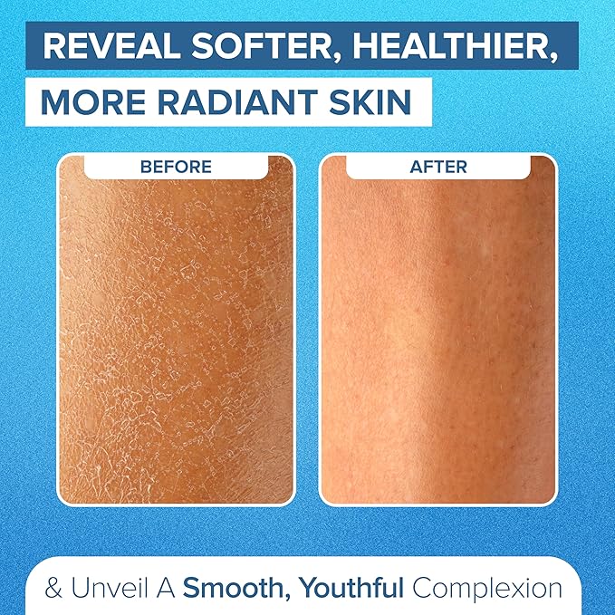 DEEP Exfoliation Body Exfoliating Glove for Dead Skin Removal (1 Glove) NYK1 Exfolimitt Exfoliating Mitt for Smooth, Healthy & Glowing Skin - Washable, Quick-Drying & Gentle On Skin